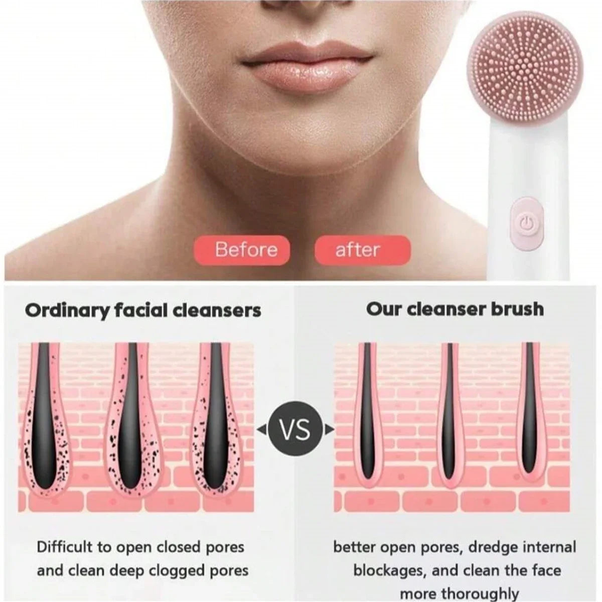 Electric Sonic Facial Cleansing Brush – Deep Exfoliating Skincare Tool